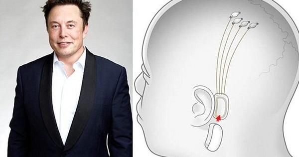 Tashmë është zyrtare, kompania e Elon Musk merr miratimin e FDA-së për të testuar çipin e trurit te njerëzit